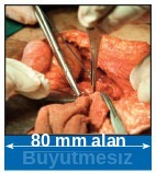 Büyütmesiz