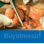 Büyütmesiz